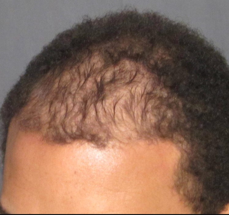 Before transformation