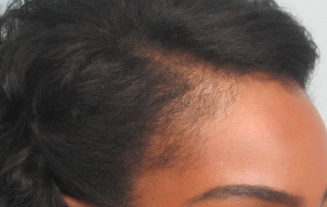 After transformation